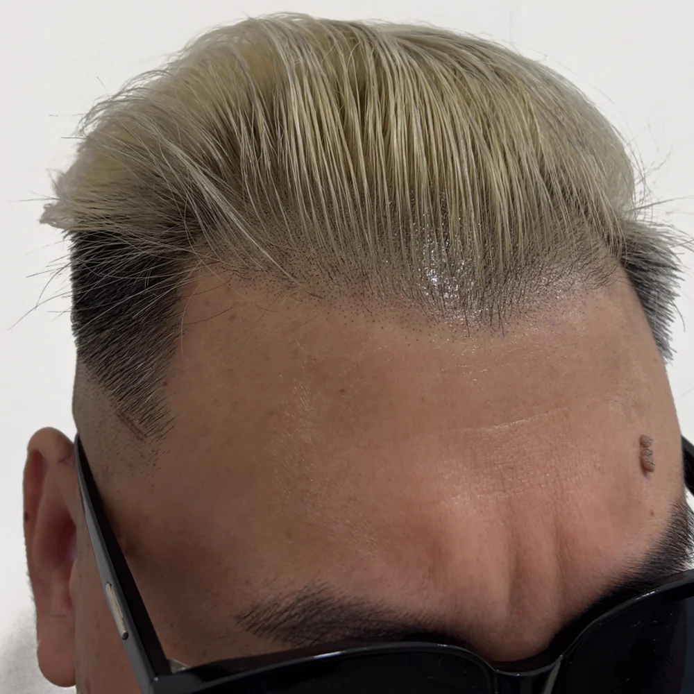 男士髮線・操作後