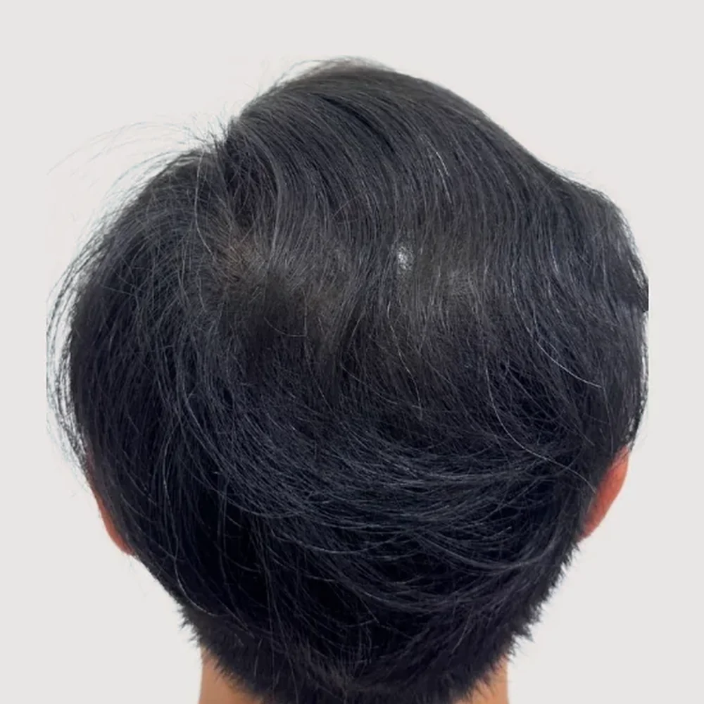 男士頭頂・操作後